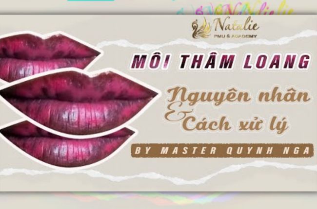 Nguyên Nhân Và Cách Xử Lý Môi Thâm Loang Sau Bong