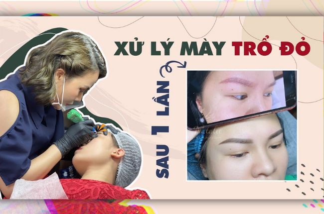 Cách Xử Lý Lông Mày Trổ Đỏ Chỉ Sau Một Lần Hiệu Quả 