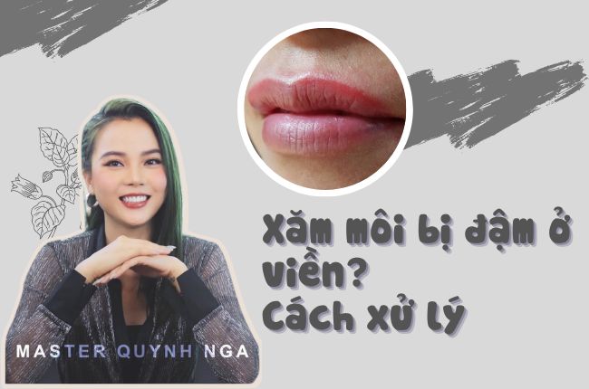 Tai Nạn Xăm Môi Bị Đậm Ở Viền. Cách Xử Lý.