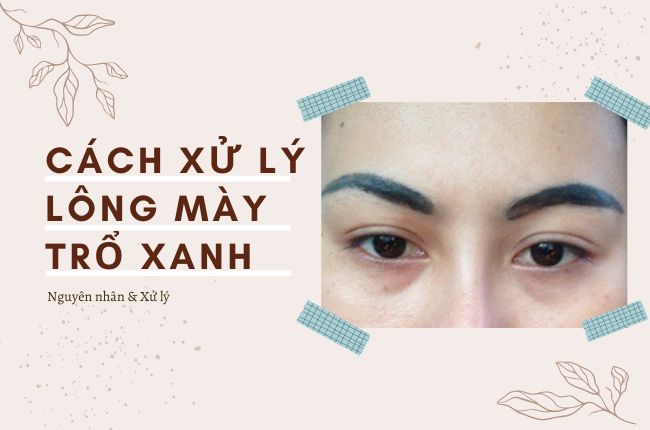 Hướng Dẫn 3 Cách Xử Lý Lông Mày Bị Trổ Xanh