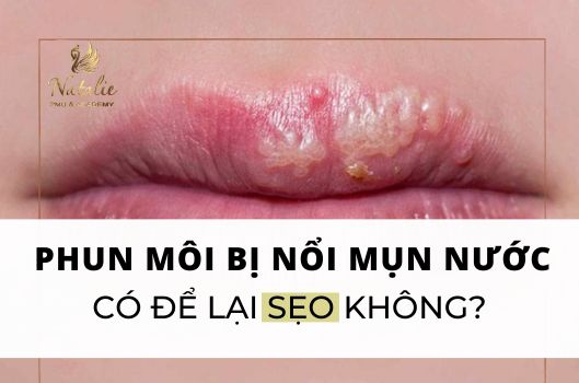 Nổi Mụn Nước Sau Phun Môi Có Để Lại Sẹo Không?