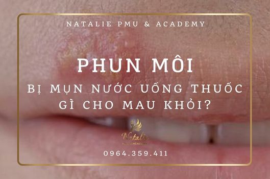 Phun Môi Bị Mụn Nước Uống Thuốc Gì Cho Mau Khỏi?