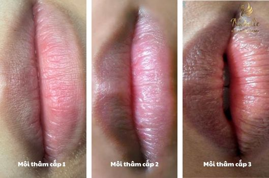 muc-khu-tham-moi2