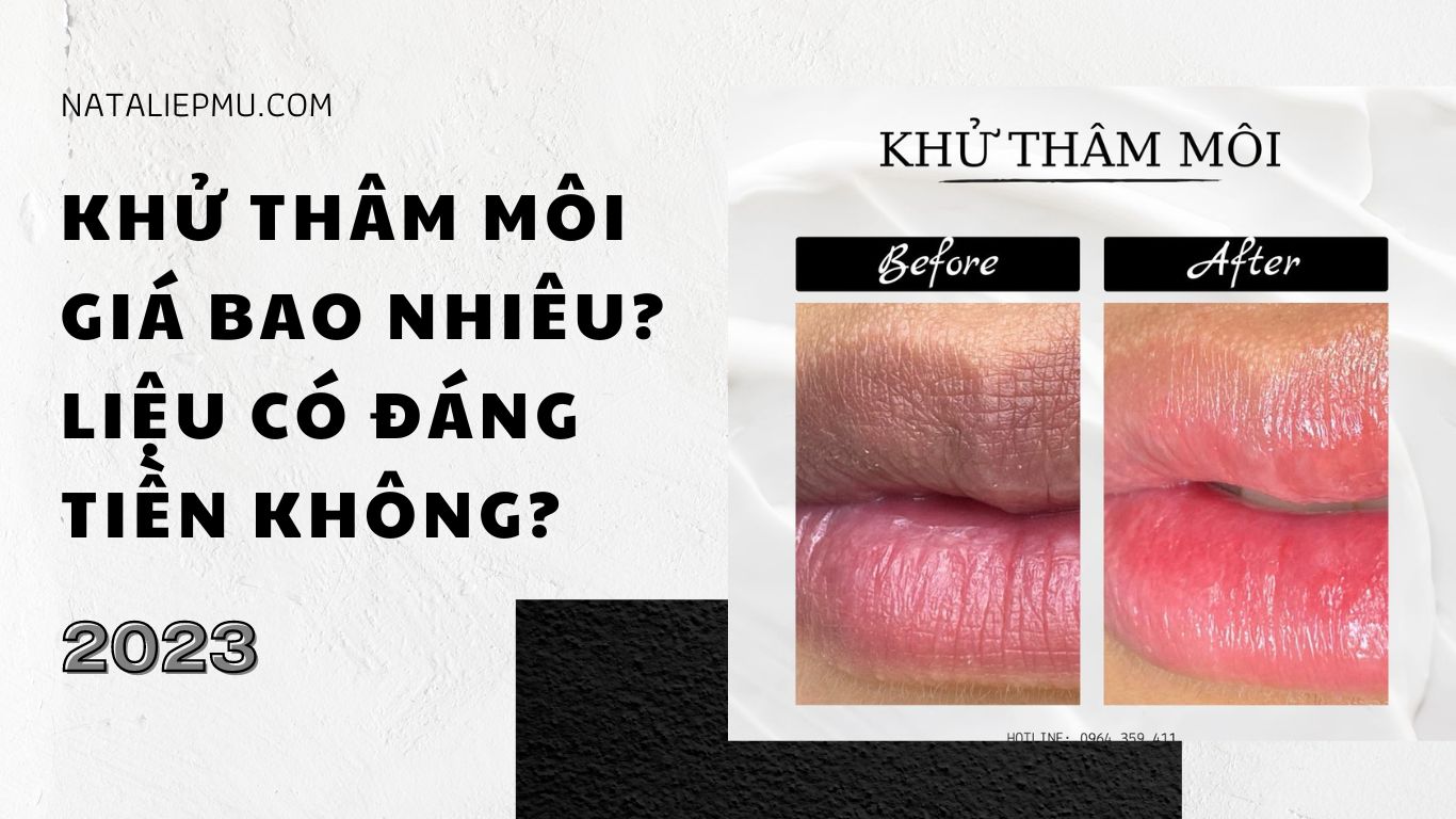 Khử thâm môi giá bao nhiêu? 3 yếu tố tác động đến giá khử thâm môi?