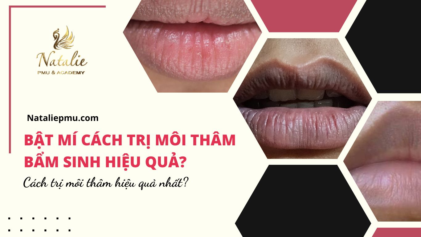 Bật Mí Cách Trị Môi Thâm Bẩm Sinh Hiệu Quả?
