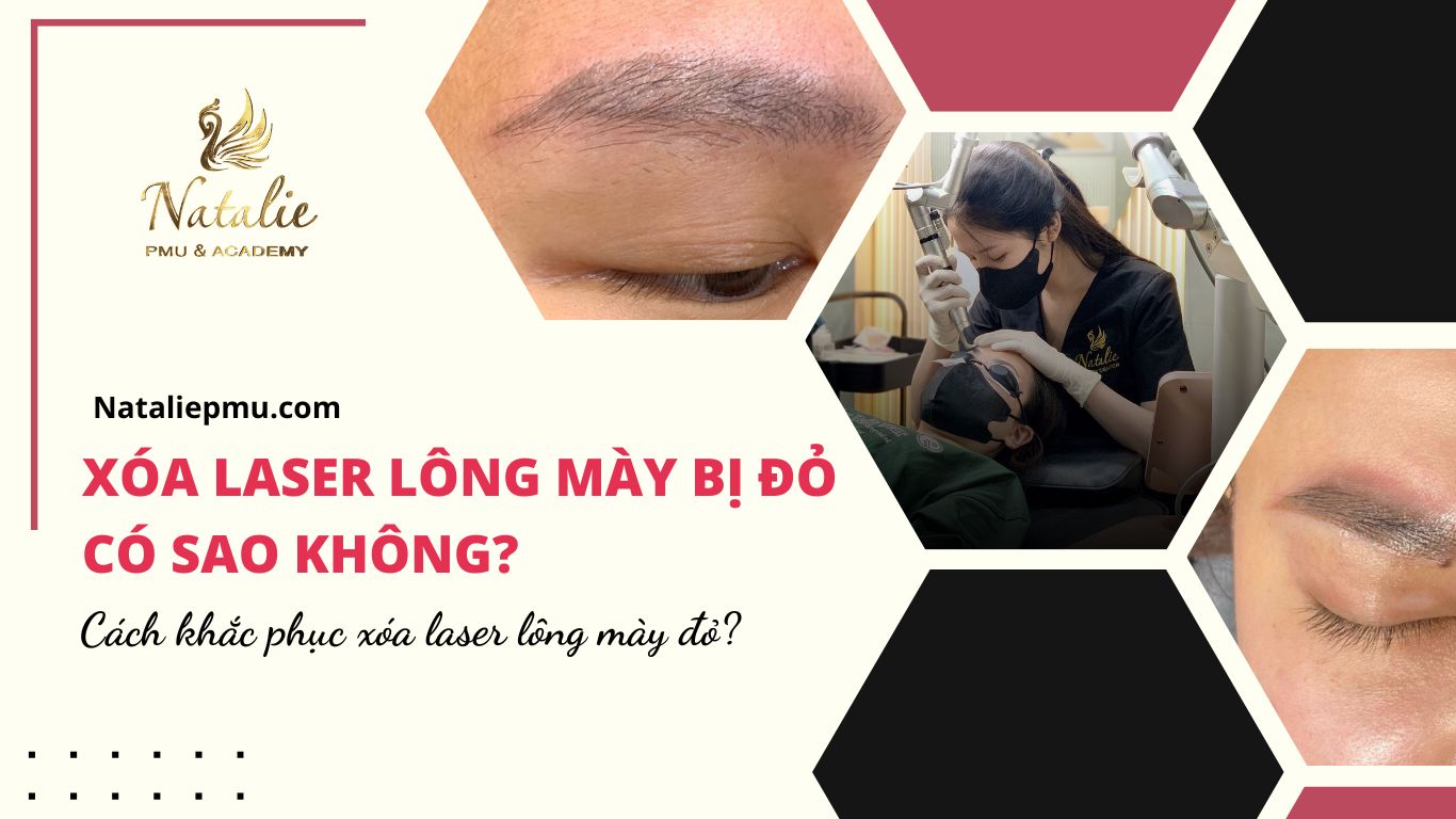 Xóa Laser Lông Mày Bị Đỏ Có Sao Không? Cách Xử Lý Như Nào?