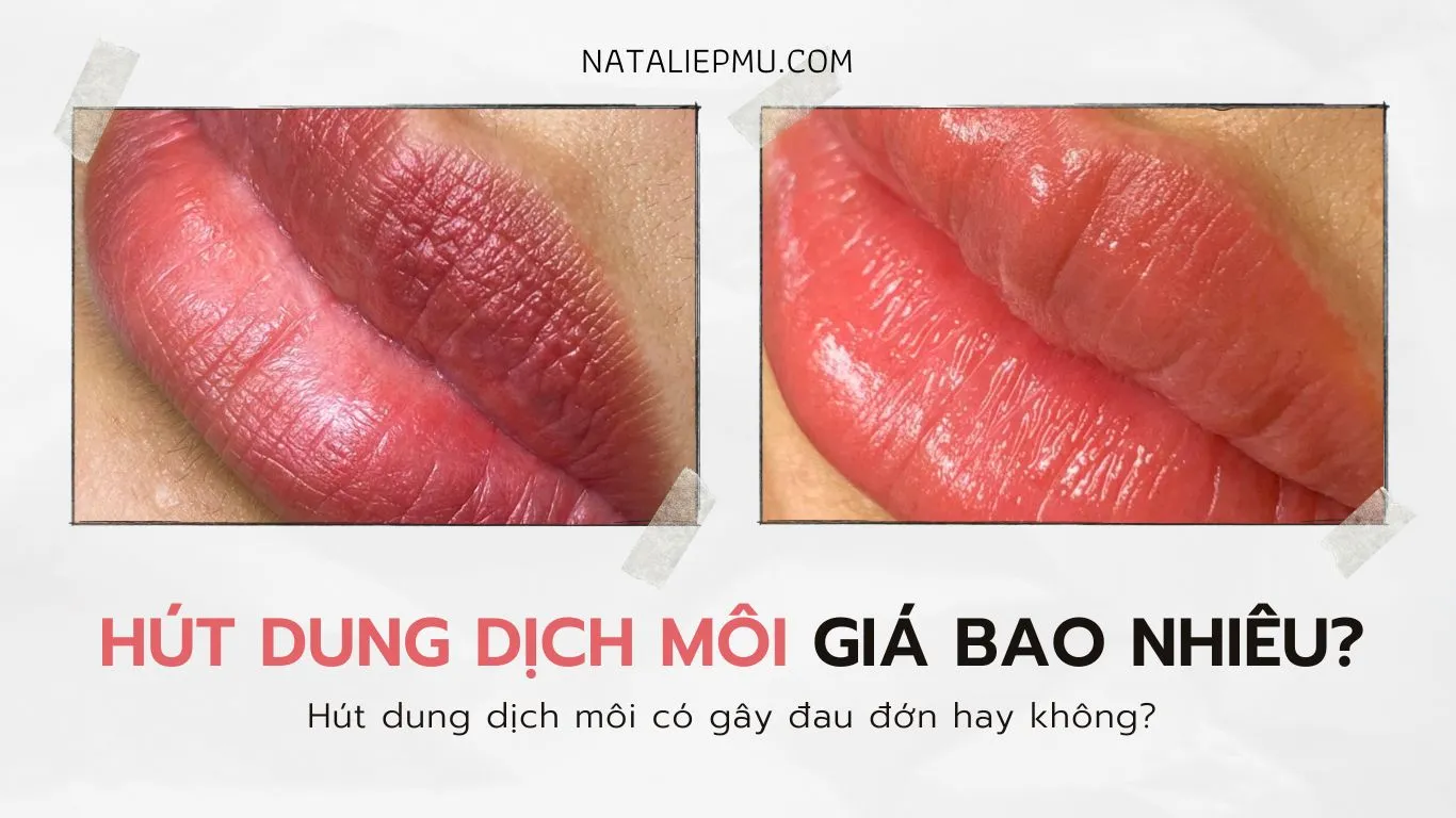 Hút Dung Dịch Môi Giá Bao Nhiêu? Có Gây Đau Đớn Không?