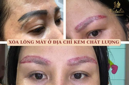 dieu-khac-chan-may-co-xoa-duoc-khong-9