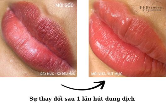 hut-dung-dich-moi-bao-nhieu-lan-thi-het