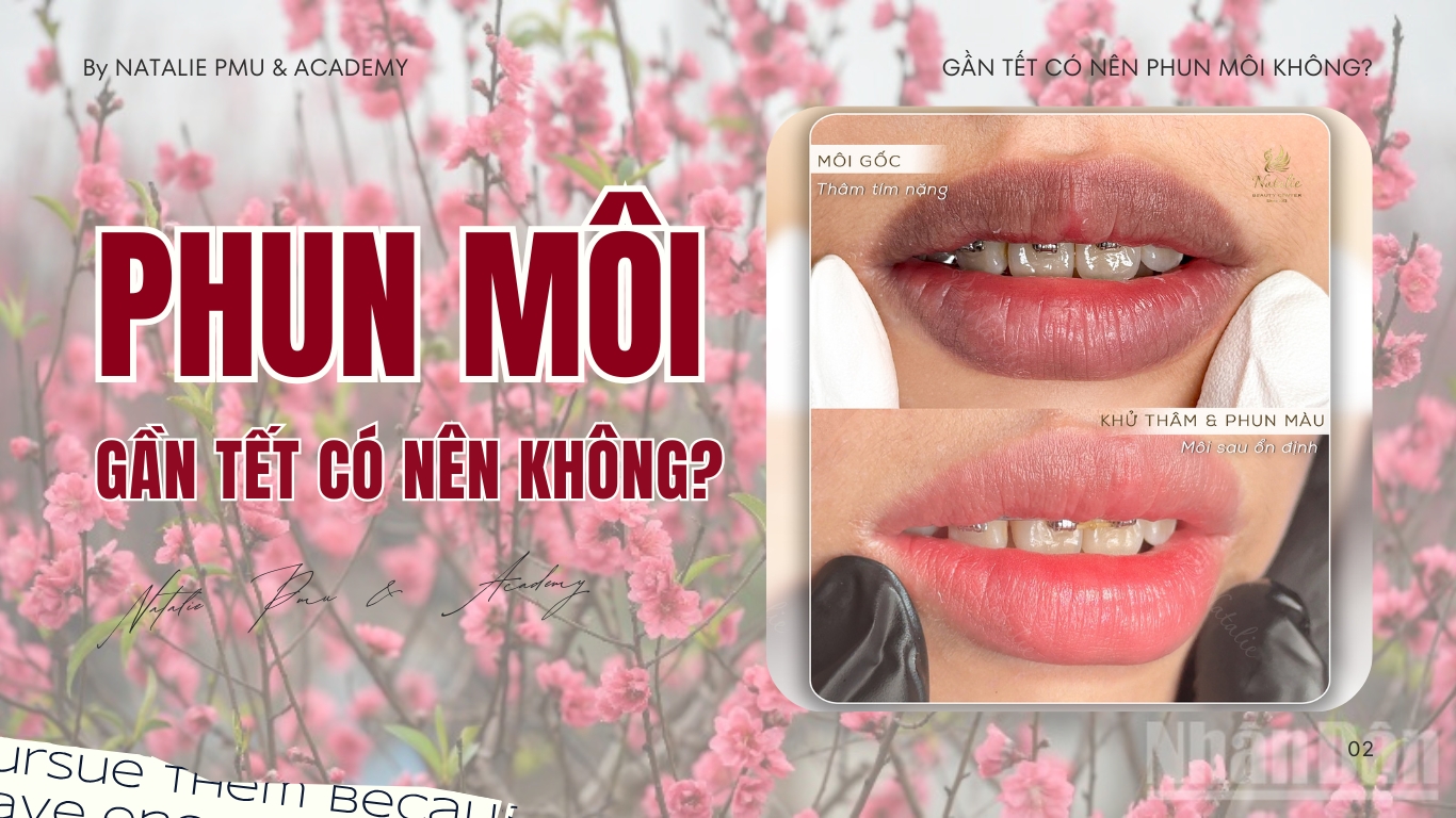 Gần Tết Có Nên Phun Môi Không? Bí Quyết Để Có Đôi Môi Xinh Đón Tết