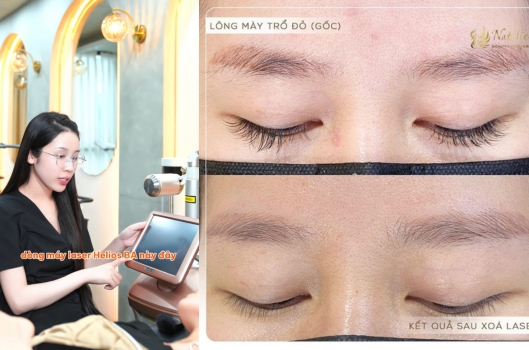 natalie-ia-chi-xoa-xam-uy-tin-tai-ha-noi