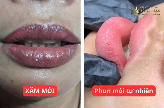 xam-moi-va-phun-moi
